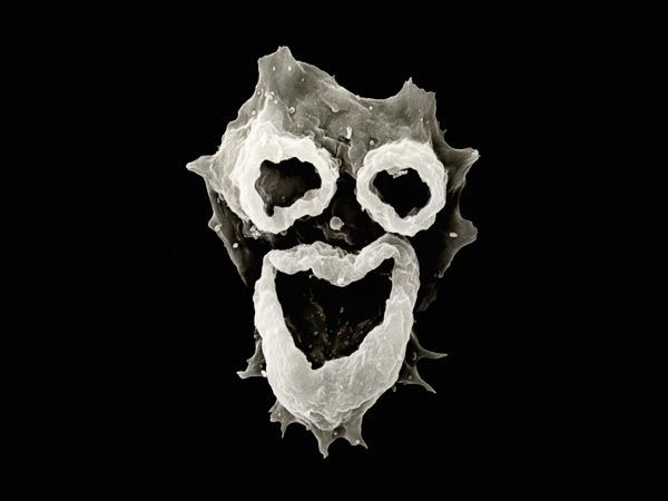 amoeba-naegleria-fowleri