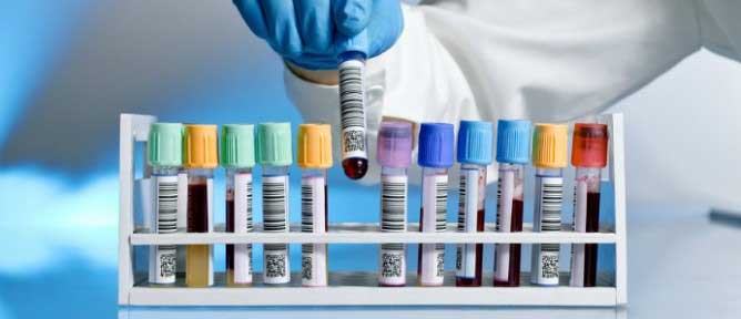 Right blood test breast cancer