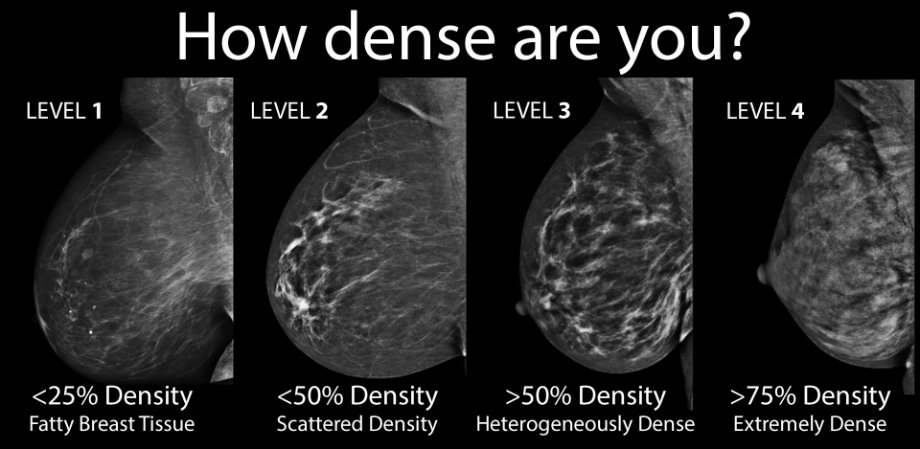 fibrocystic breast changes lumps that are normal