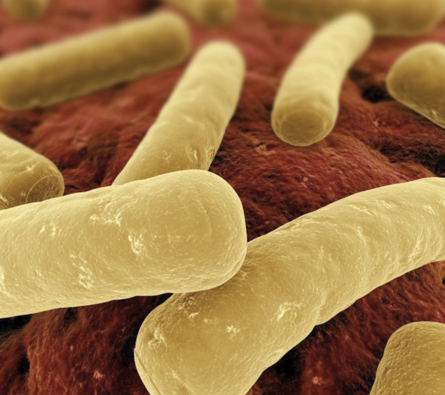 Bacteria