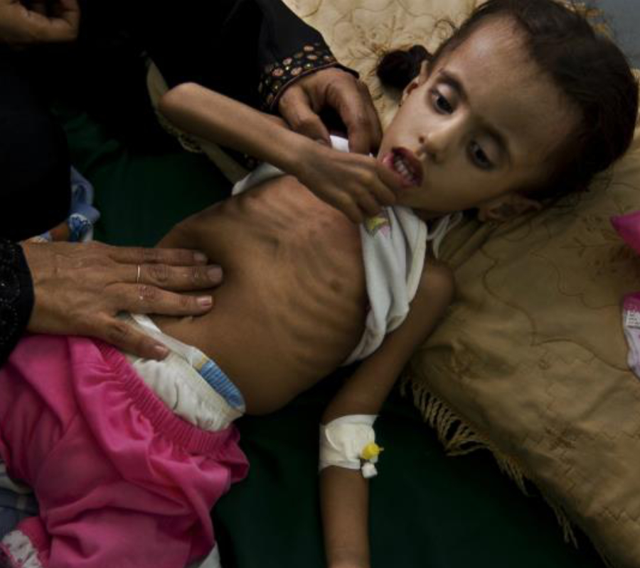 Cholera, Yemen