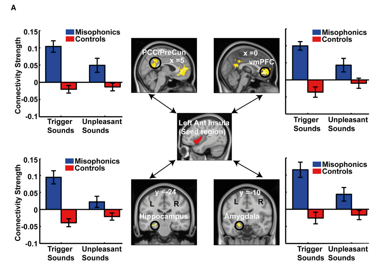 Brain Scans