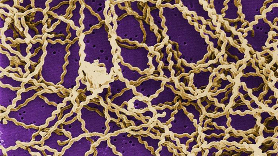 Leptospirosis