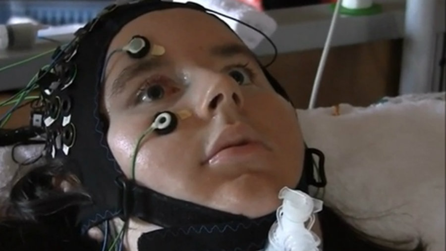 Image credit: Wyss Center / CTV News