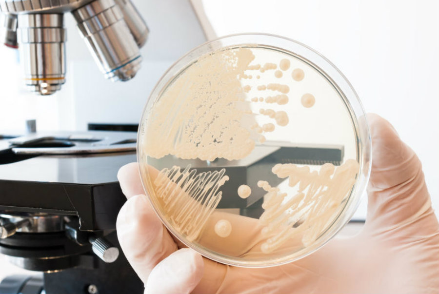New fungus outbreak alerts health authorities in the US