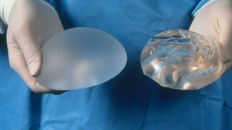 Some researchers say that textured (right) implants are more likely to be associated with the disease. Image credit: Science Photo Library / BBC News