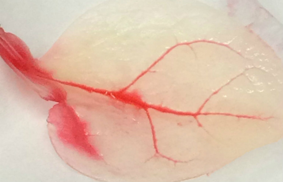 Decellularized spinach leaf. Image credit: WPI / Bostonmagazine.com