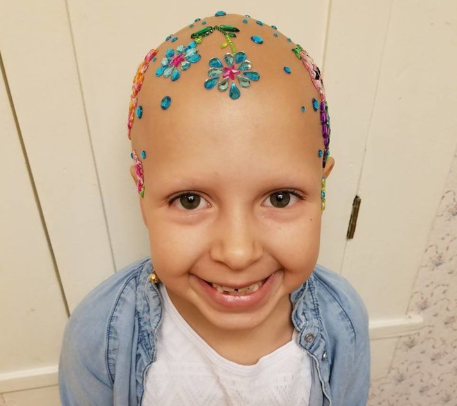 A 7-year-old girl with alopecia wins 'Crazy Hair day ...