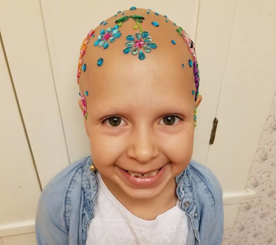 A 7 year old Girl With Alopecia Wins Crazy Hair Day Competition A 7 year old Girl With Alopecia Wins Crazy Hair Day Competition