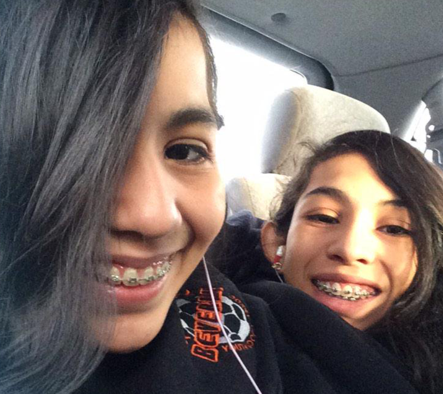 Conjoined Twins