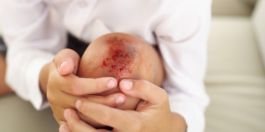 Hemophilia