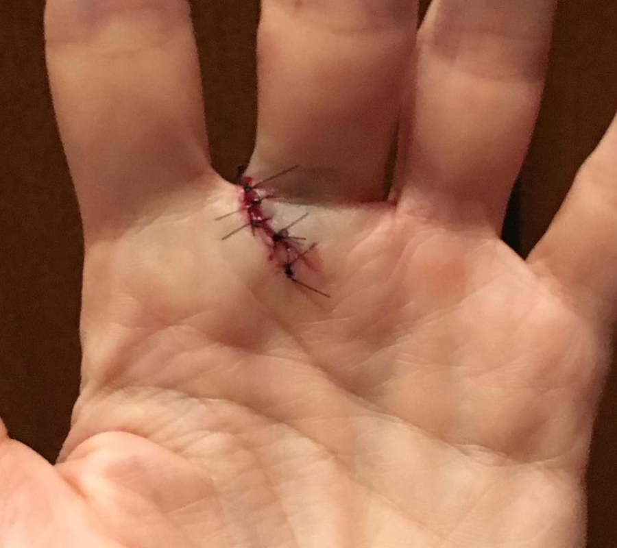 Avocado Hand
