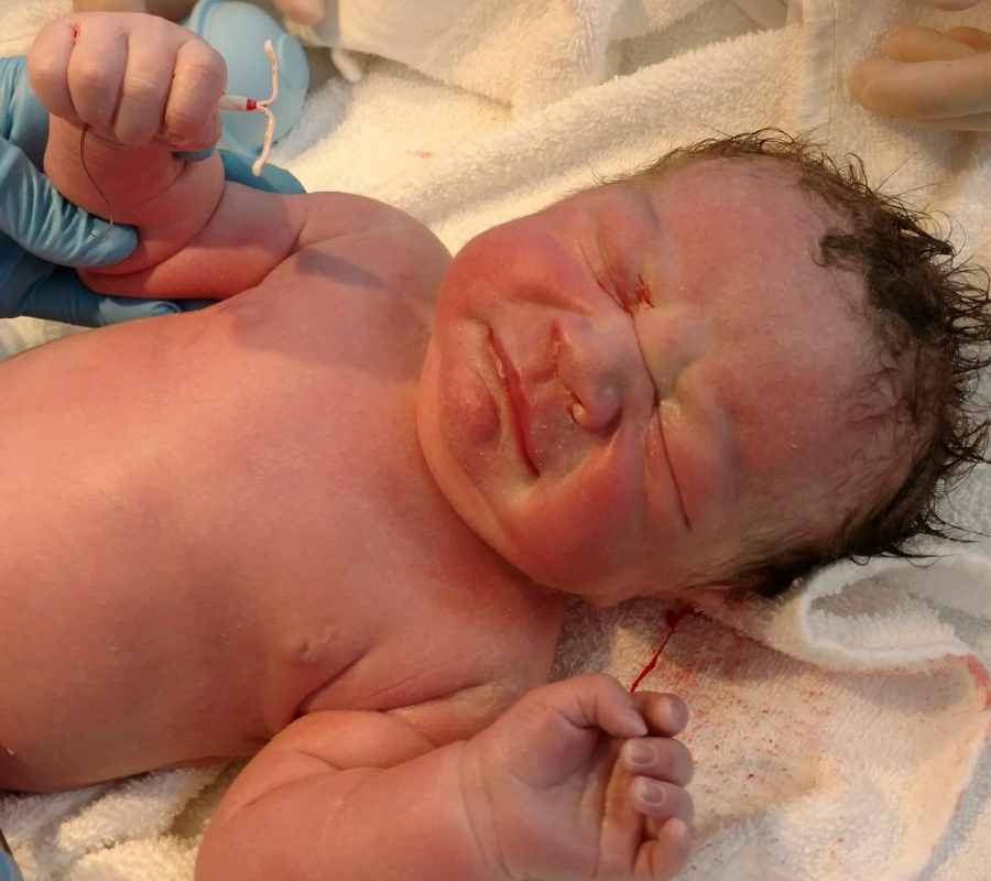 Lucy Hellein, IUD Baby