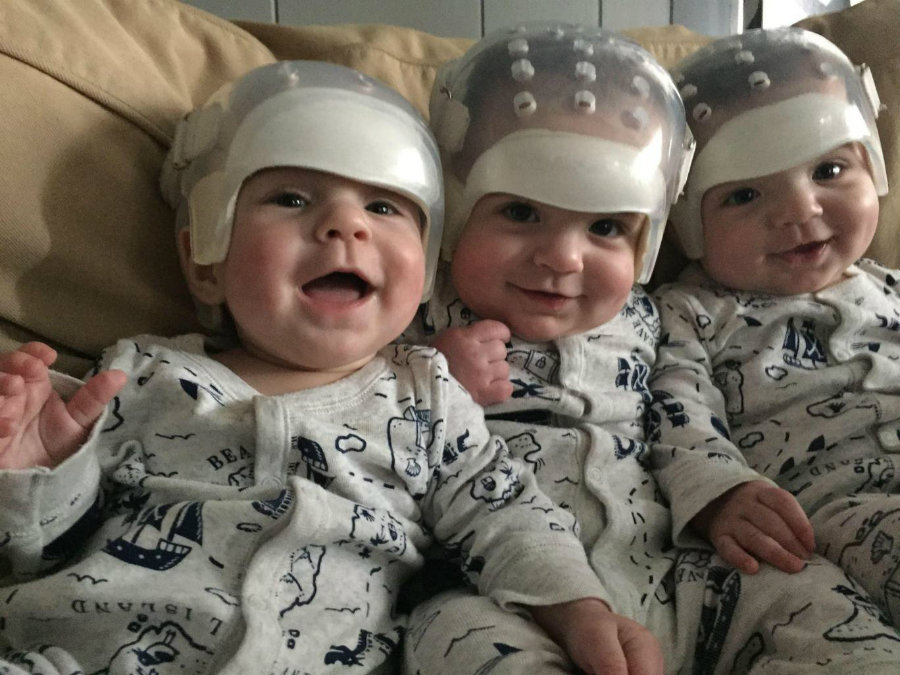 Kaden, Jackson, and Hunter were operated upon at Stony Brook University Hospital in January. Image credit: Facebook page of Stony Brook Children's Hospital / Independent