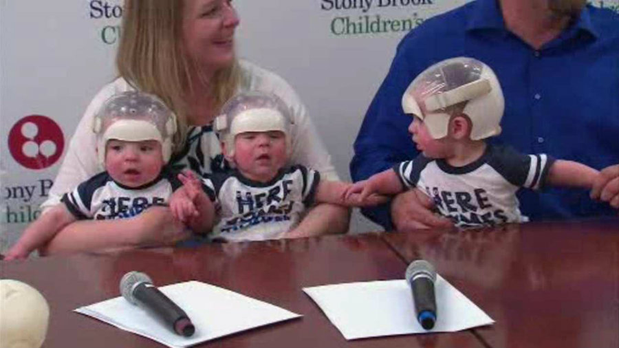 Three New York infants underwent surgery to treat their skulls whose soft tissue fused prematurely. Image credit: ABC 7