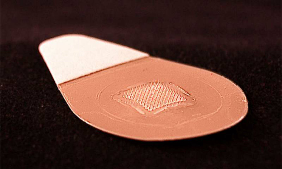 Microneedles are so small that 100 of them, arranged on a patch, can fit under a thumb. Image credit: Georgia Tech / MedicalXpress