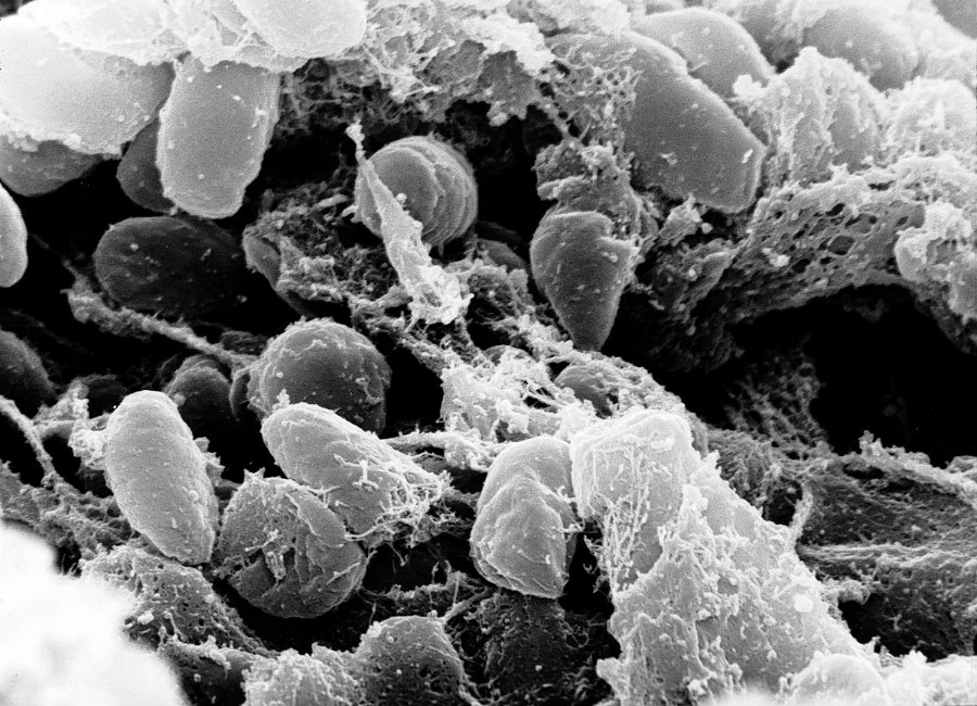 The plague is a disease that affects both human and some mammals, and it is caused by the bacterium Yersinia pestis. Image credit: Wikipedia