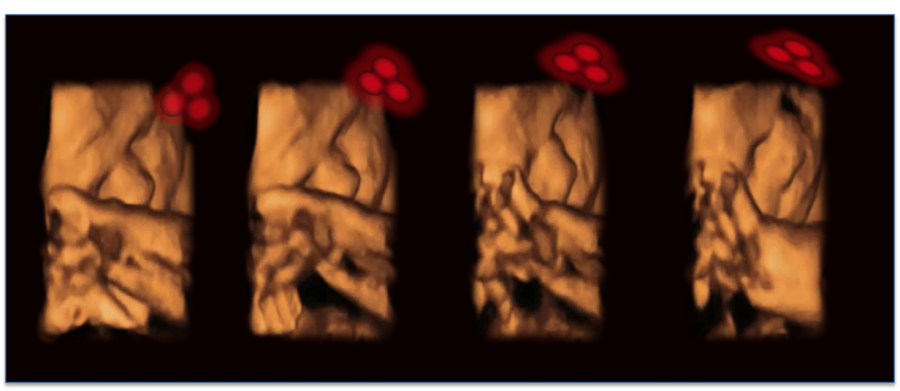Ultrasound of fetus
