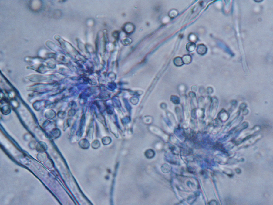 "Aspergillus Versicolor, a potent producer of sterigmatocystin (STG), is one of the most frequent fungal contaminants of indoor environments that can be found together in building materials, in dust or in the air samples.” Image Credit: MYCOTA