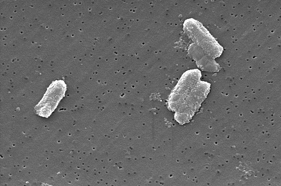 Vibrio vulnificus or Citrobacter freundii. Image Credit: CDC