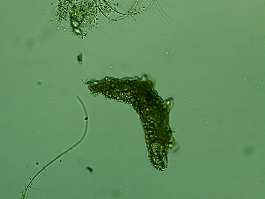 Milnesium tardigradum or Tardigrades are microscopic creatures that live in the water and are also known as water bears. Image credit: Antiprotons Youtube Channel