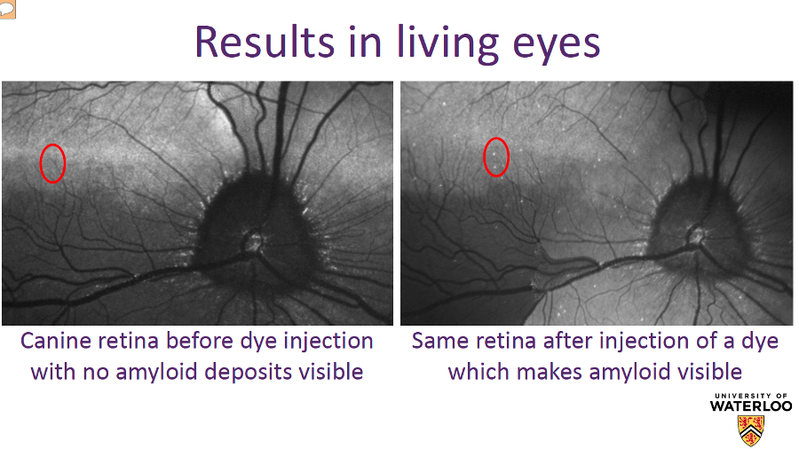 Before and after of the new Alzheimer's retina test. Image Credit: University of Waterloo.