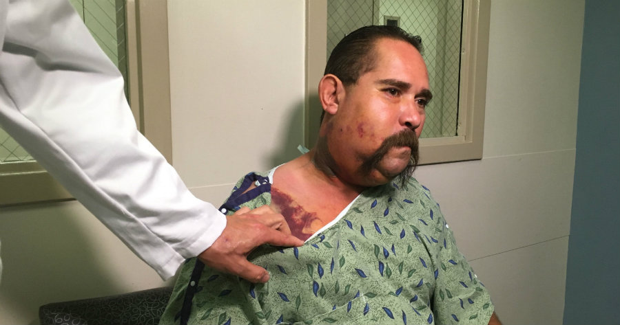 Victor Pratt, 48, was bitten September 7 during his son’s birthday party near Coolidge, outside Phoenix. Image credit: Chris McCrory / The Republic / AZcentral