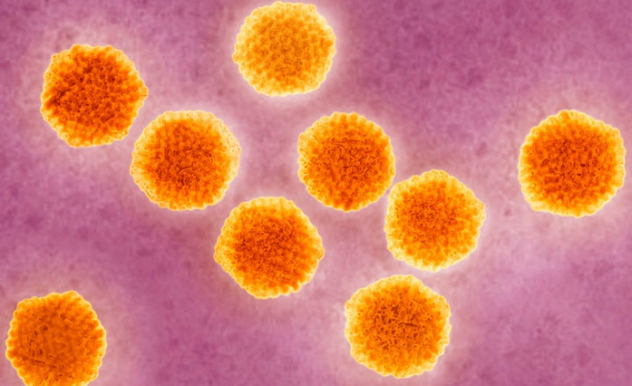 Hepatitis A outbreak US, Hepatitis A outbreak California, Hepatitis A San Diego