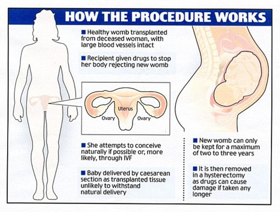 Uterus transplant, Baby is born in Texas, Transplanted uterus baby in Texas, First case in America, Pregnancy in the US