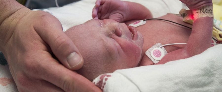Uterus transplant, Baby is born in Texas, Transplanted uterus baby in Texas, First case in America, Pregnancy in the US