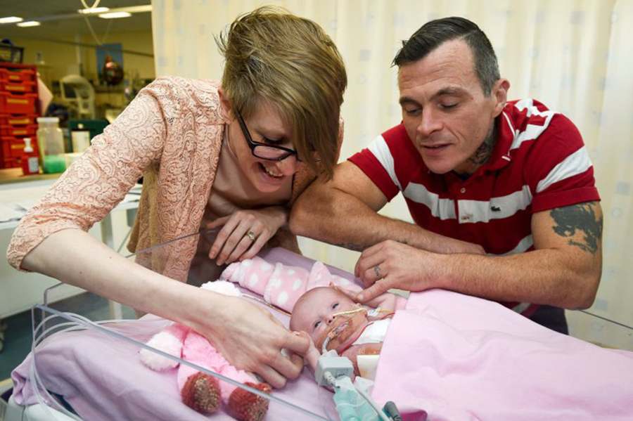 Baby born with heart outside the body, United Kingdom, Ectiopia cordis,