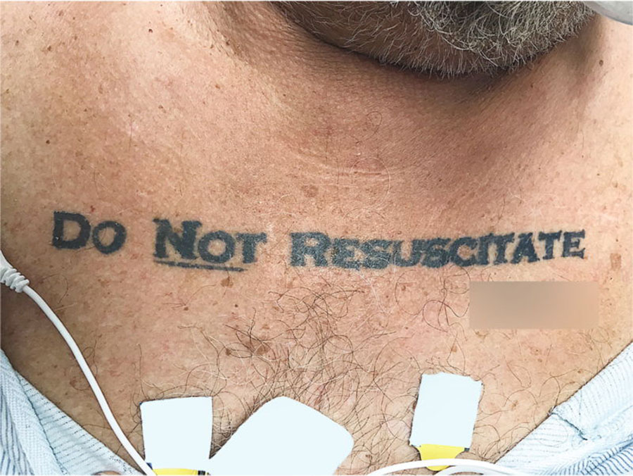 Do not resuscitate, Tattoo, Jackson Memorial Hospital, Man with Do Not resuscitate tattoo, Tattooed man Miami hospital, Do Not Resuscitate tattoo