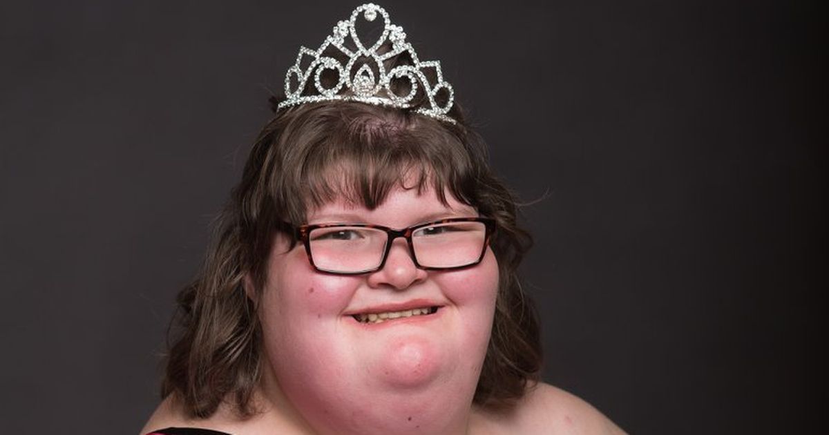 Prader–Willi syndrome, pageant