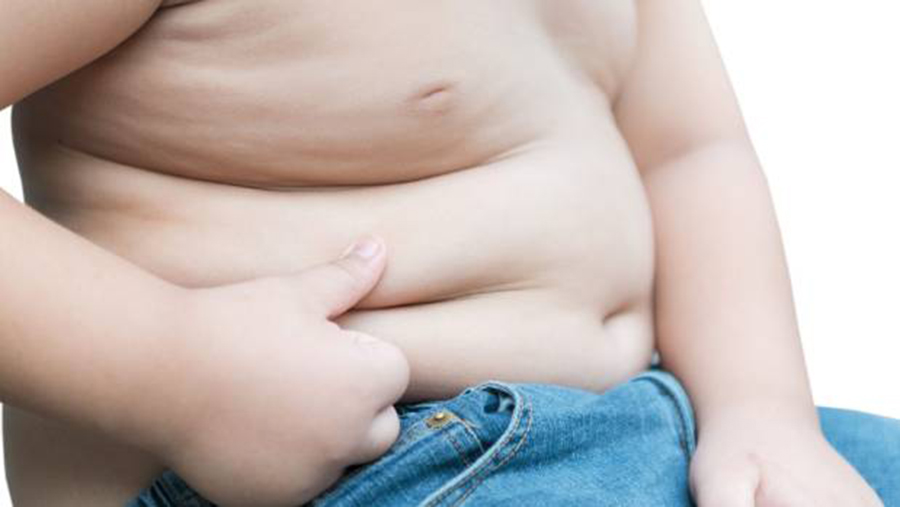 Children obesity, Lifestyle