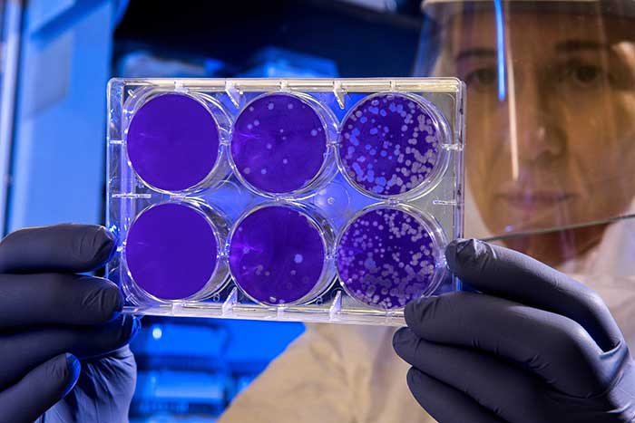 Type of Chlamydia Bacteria Causing Sexually Transmitted Diseases Found In Arctic Ocean