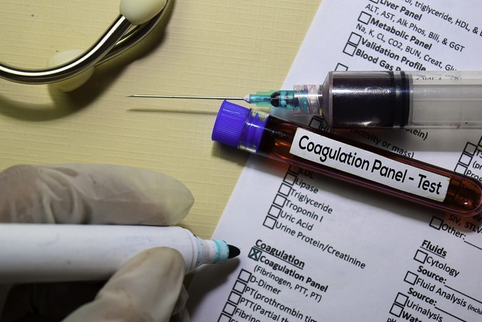 Unprecedented Number of Blood Clots in COVID-19 Patients Necessitates Use of Blood Thinners