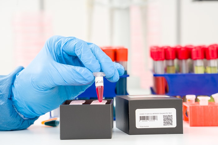46,000 COVID-19 Cases Reported On Friday, Bringing Total Cases in the US to 2.5 Million