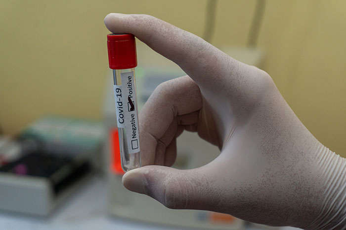 1,043 Students Test Positive to COVID-19 in University of Alabama Since August 19 Classes Started