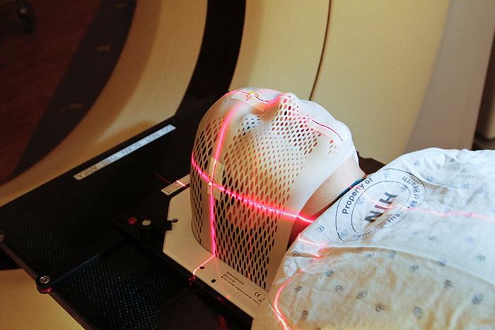 Understanding how Pico Laser Treatment is done in Singapore