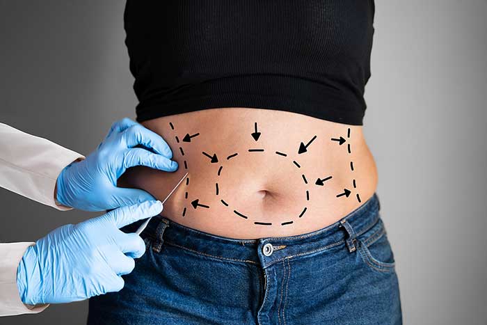 What Is The Science Behind Liposuction?